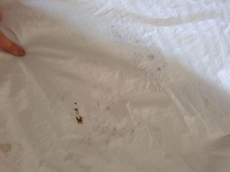 The stains on bedsheets we were penalised for without our consent